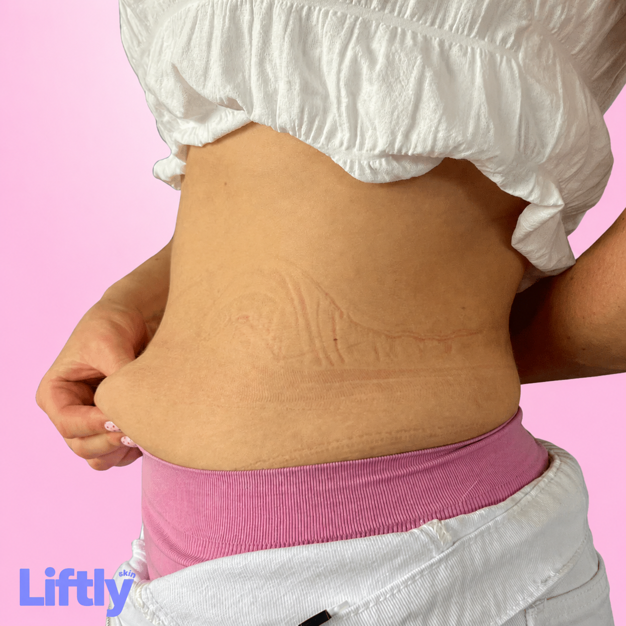 Liftly Brzuch 5