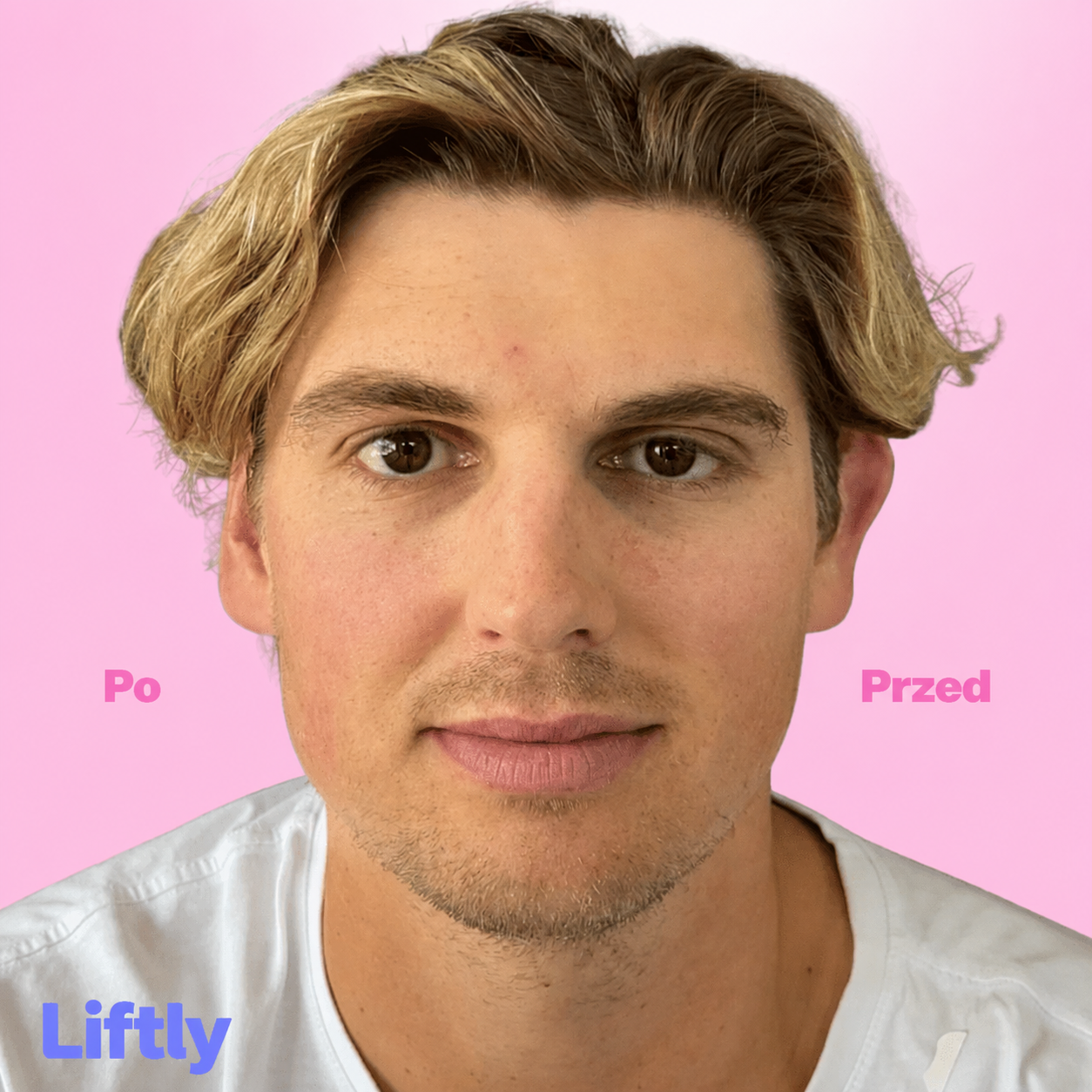 Liftly Uszy 3