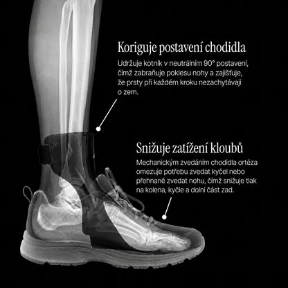 StepLift™ – ortéza na padající nohu